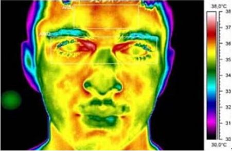 紅外熱像儀在中醫(yī)用的四項診斷功能