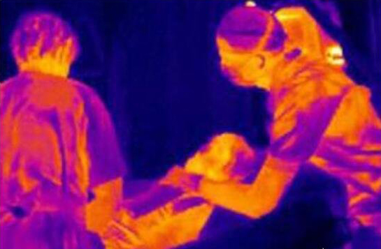 紅外熱像儀醫(yī)用的優(yōu)點(diǎn)