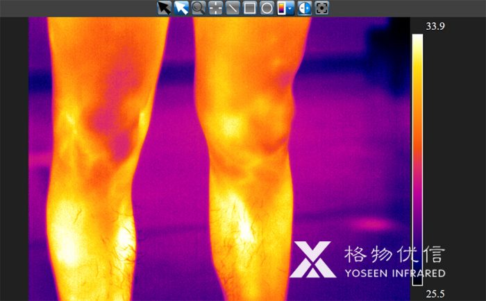 使用格物優(yōu)信紅外熱像儀拍攝的老板的腿毛紅外熱像圖