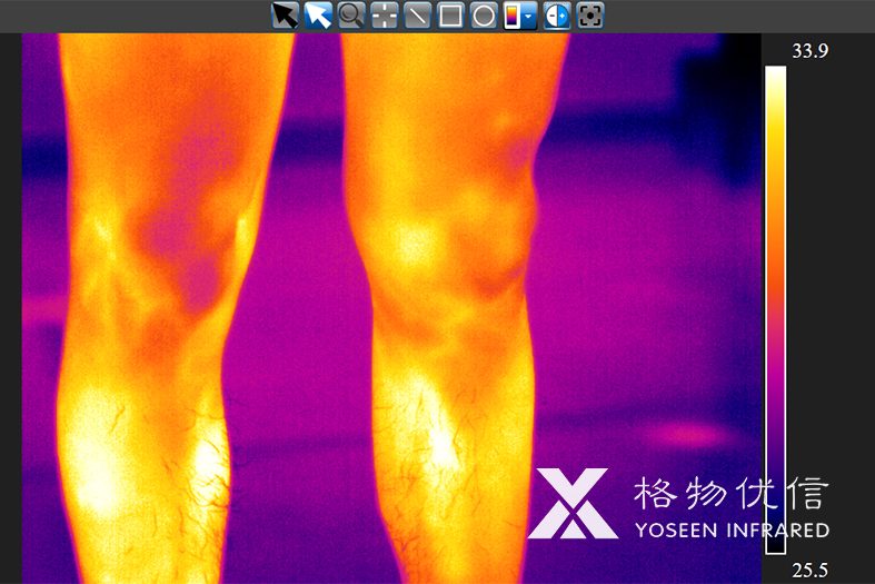 使用格物優(yōu)信紅外熱像儀拍攝的老板的腿毛紅外熱像圖