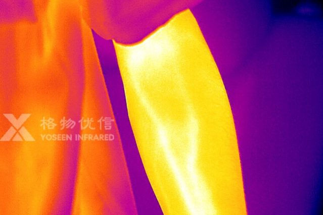 格物優(yōu)信紅外熱像儀拍攝的人體胳膊熱像圖
