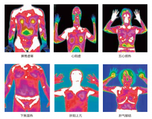 人體測溫?zé)嵯駜x在體檢中的應(yīng)用