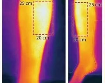 熱成像開辟了以功能學(xué)為主的全新醫(yī)學(xué)影像領(lǐng)域
