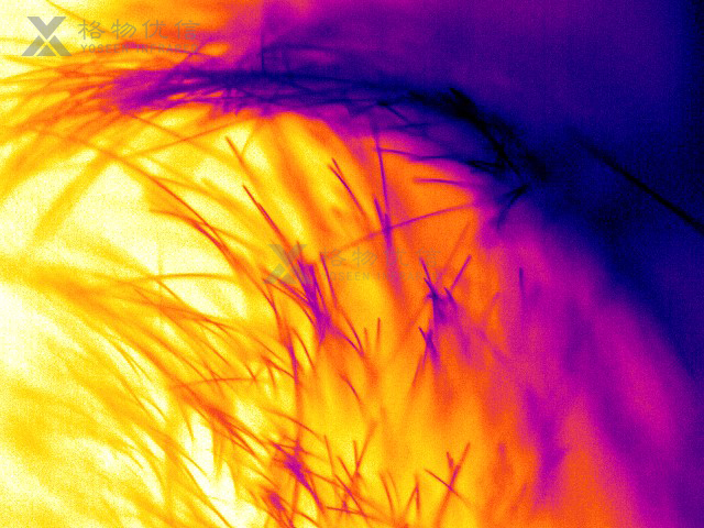 微距鏡頭清晰監(jiān)測(cè)皮膚毛發(fā)