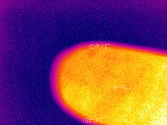 微距鏡頭清晰監(jiān)測(cè)皮膚毛發(fā)