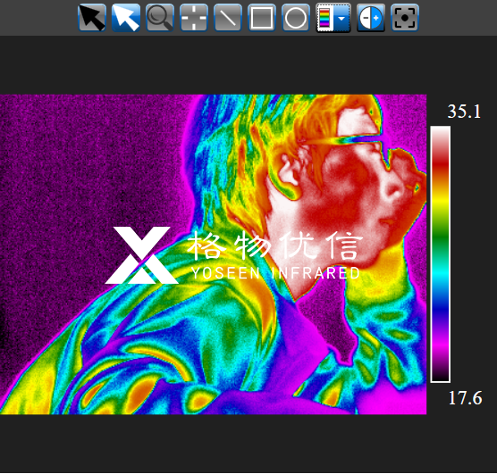 中醫(yī)診療可視化數(shù)字化紅外熱像儀的全面應用
